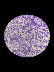 A smear of yeasts Wickerhamomyces anomalus under a microscope is stained with gentian violet or Gram