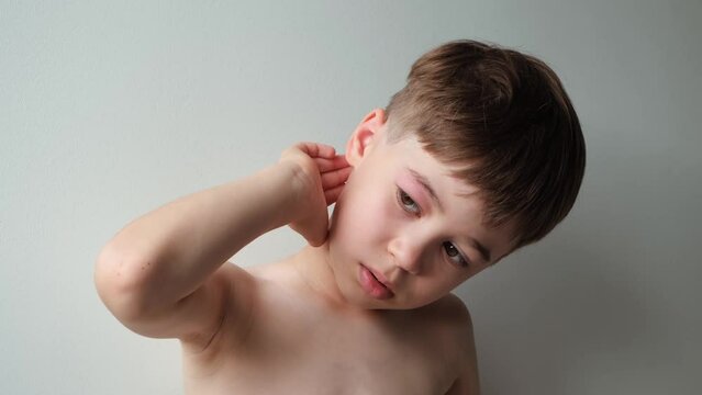 The boy looking at the camera rubbing and scratching head with a swollen eye from an insect bite. Close-up view. Angioedema. Allergic response. Red inflamed upper eyelid. Inflammation. Itching bites