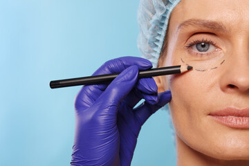Doctor with pencil preparing patient for cosmetic surgery operation on light blue background,...