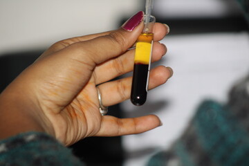 Serum Draw Pipe Of A Laboratory Semi Auto Chemistry Analyzer. Selective Focus. india 