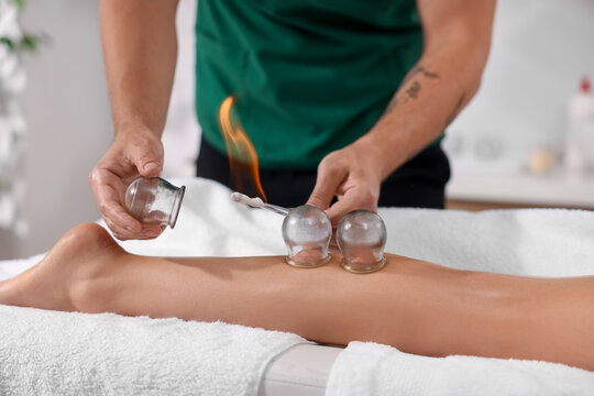 Therapist giving fire cupping treatment to patient indoors, closeup