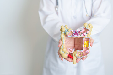 Doctor holding human Colon anatomy model. Colonic disease, Large Intestine, Colorectal cancer, Ulcerative colitis, Diverticulitis, Irritable bowel syndrome, Digestive system and Health concept - obrazy, fototapety, plakaty