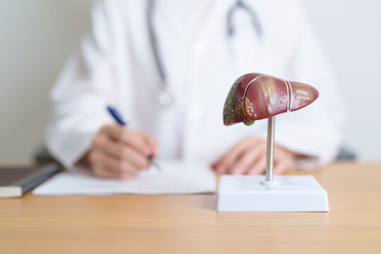 Doctor with human Liver anatomy model. Liver cancer and Tumor, Jaundice, Viral Hepatitis A, B, C, D, E, Cirrhosis, Failure, Enlarged, Hepatic Encephalopathy, Ascites Fluid in Belly and health concept
