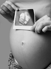 Black and white photo of Pregnant female is holding sonogram baby embryo image over a pregnant belly.