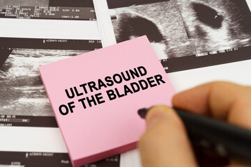 On the ultrasound pictures there are stickers that say - Ultrasound of the bladder