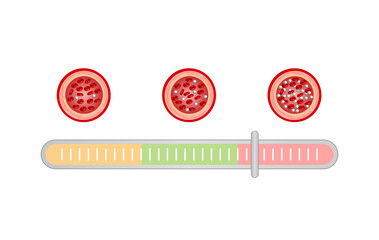 Blood Glucose Levels. Normal level, hypoglycemia (low blood sugar), hyperglycemia (high blood sugar), sugar test. vector diagram
