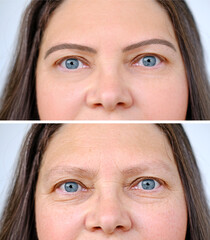 close up part of mature woman 50 years old, human face, wrinkles around eyes, overhang, skin...