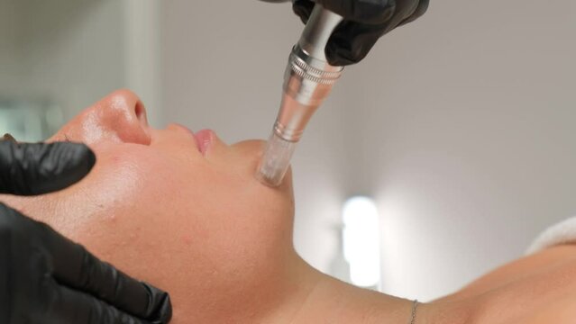 Close-up portrait of a beautiful aged woman during microneedling with dermapen from a beautician.