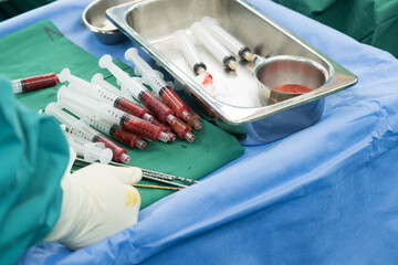 Fat in syringe for breast augmentation surgery in operation room.Concept of plastic surgery...