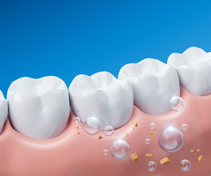 Tooth whitening, Tooth Cleaning, Healthy gums and teeth with fluoride Liquid Bubble Protect and Cleaning. Oral hygiene and Dental concept, 3d rendering.