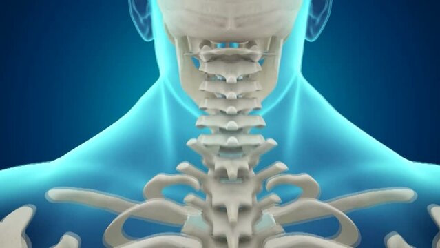 인체의 골격 구조와 척추 뼈 사이의 추간판이 튀어나와 통증을 유발하는 도식화 CG 영상 