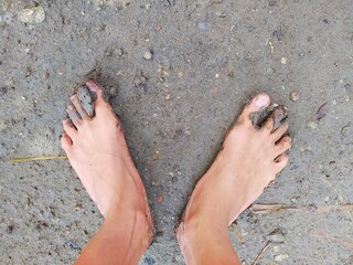 Dirty feet from activities.