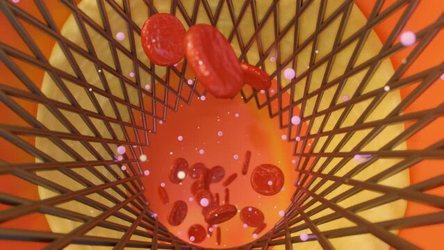 3d animation of a stent implanted in a blood vessel, with nanodrugs being released from the stent into the bloodstream.