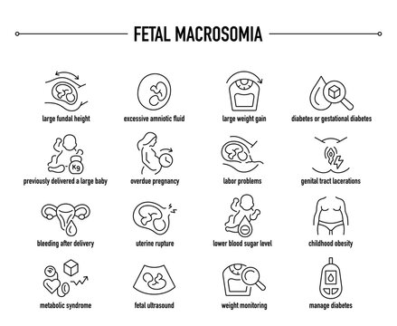 Fetal Macrosomia symptoms, diagnostic and treatment vector icons. Line editable medical icons.