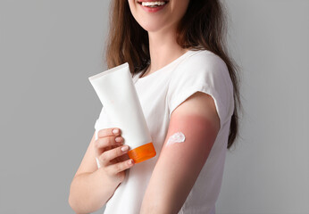 Allergic young woman with sunburned skin and cream on grey background, closeup