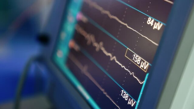 Curved lines run and figures change quickly on the monitor of lung ventilator. Top close up view on the medical equipment.