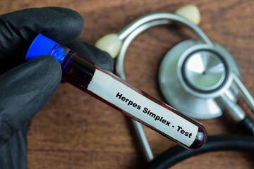 Herpes Simplex - Test with blood sample on wooden background. Healthcare or medical concept
