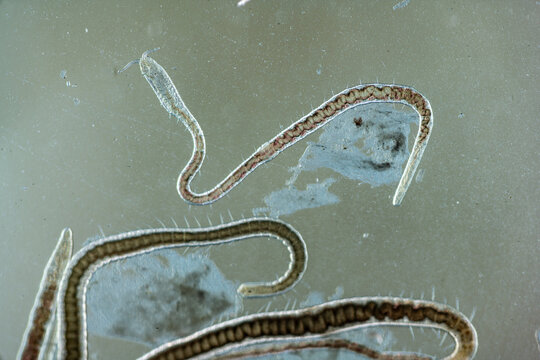 Naidid Worms