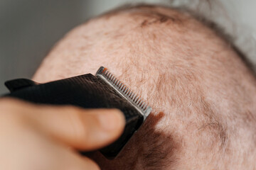 shaving woman because of a cancerous tumor. removal of hair on the head with an electric razor before surgery. hair loss due to cancer. shaving the grandmother's head before a course of chemo therapy