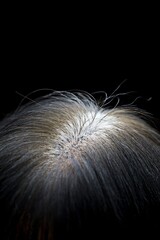 Aging Gracefully: 4K Ultra HD Close-Up of Grey Hair Growth