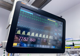 Hospital monitor displays vital signs, healthcare concept, medical equipment, patient health...
