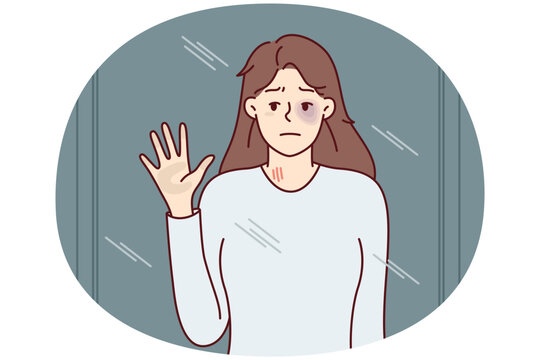 Unhappy woman with black eye looks in mirror or out window. Girl suffers after getting bruise from domestic violence and needs help and support of friends or psychotherapist. Flat vector image