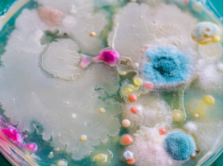 colonies of bacteria and other microorganisms in a Petri dish on the surface of the nutrient medium