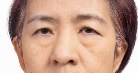 The ptosis or droopy eyelids in asian senior woman. - obrazy, fototapety, plakaty