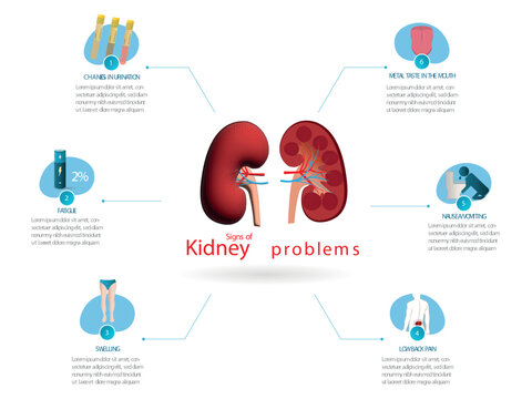 Infographic about the main signs that indicate kidney problems, in the center a kidney and its parts surrounded by the main signs, flat design on white background.
