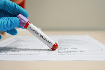 Liver Function Test. Laboratory worker with tube of blood sample and form at table, closeup