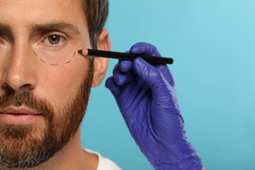 Doctor with pencil preparing patient for cosmetic surgery operation on light blue background, closeup - obrazy, fototapety, plakaty