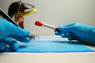 Liver Function Test. Laboratory worker with tube of blood sample filling in form at table, closeup - obrazy, fototapety, plakaty