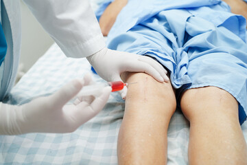 Asian doctor inject Hyaluronic acid platelet rich plasma into the knee of senior woman to walk without pain.