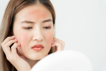 Young woman asian are worried about faces Dermatology and allergic to steroids in cosmetics....