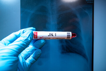 Background of SARS-CoV-2 Variant JN.1,Medical health concept