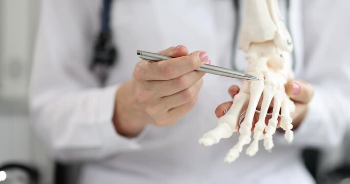 Orthopedic doctor looks at skeleton of ankle of foot. Gait disturbance causes and treatment and flat feet concept