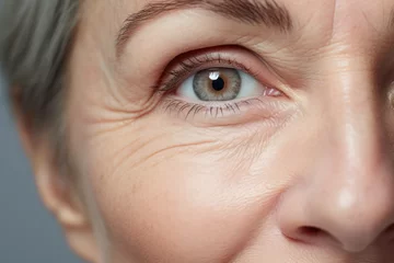Foto op Aluminium Woman adult eyelid female wrinkled health caucasian skin eye surgery face closeup woman beauty © VICHIZH