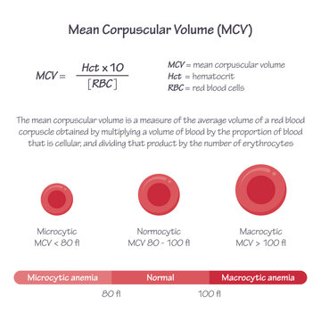 Mean Corpuscular Volume MCV medical vector illustration graphic