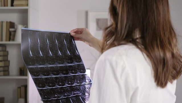 A female doctor in a white coat holds an unrecognizable X-ray of the bones of the spine. The camera is moving towards the model. Medicine and treatment of protrusion and fractures
