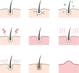 두피 문제, 모공, 탈모 원인 아이콘 벡터 일러스트
