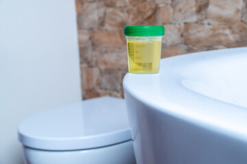 Voller Becher Urin im Bad zur Probe für den Hausarzt