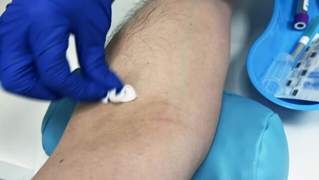 Nurse disinfects a patient's arm before drawing venous blood for analysis or donation in a clinic or hospital. Close up shot
