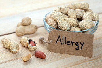 bowl of peanuts with label that says 