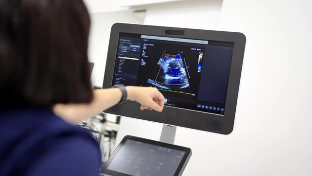 Video of the rear view of a cardiologist pointing the screen with a beating heart while performing an echocardiogram