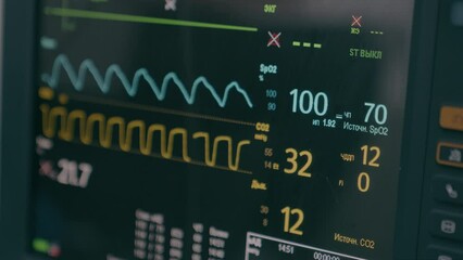 Medical equipment in hospital modern heart rate monitor in operating room display for monitoring patient vital signs anesthesia indicators on screen computer in professional healthcare clinic surgery