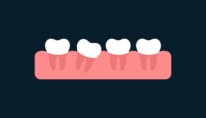 Crooked tooth in gum icon. Flat, color, isolated teeth in the gum, black background, dentistry design, crooked tooth in the gum. Vector icon