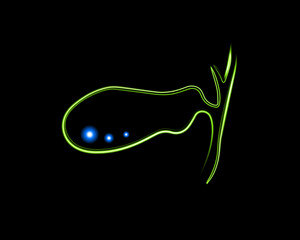 Vector isolated illustration of gall bladder with neon effect. Gallstones.