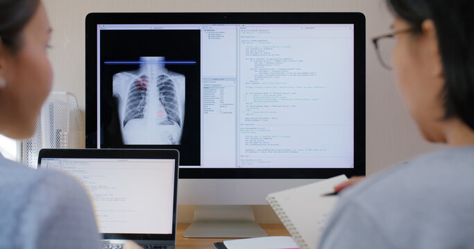 Big data AI coding screen for asian future health care smart tech IT solution. Asia team woman people code analyst job work on science project Lung X-ray scanner medtech tools meeting talk at office.