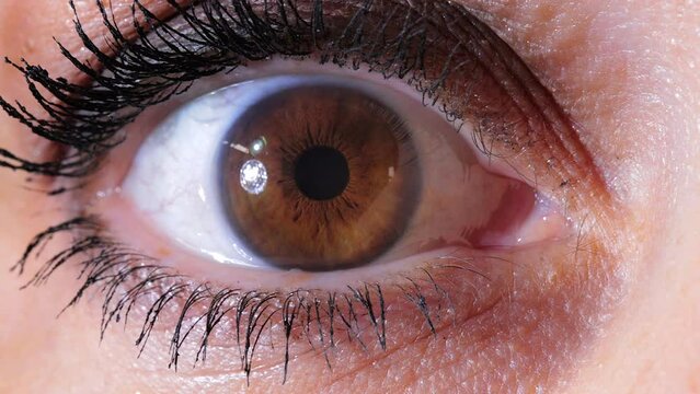 L'oeil