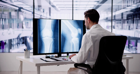 Doctor Screening Knee Bone X Ray